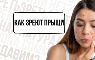 Внутренние и внешние прыщи: как выглядят, где могут появиться и сколько созревает подкожный прыщ 😬