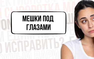 Мешки и отеки под глазами – как с ними справиться? 😊