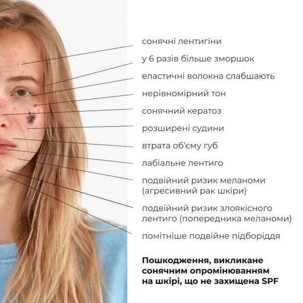 Комплекс для восстановления тона и защита от пигментации SPF 30 Hillary Tone Repair & Pigment Defense Set