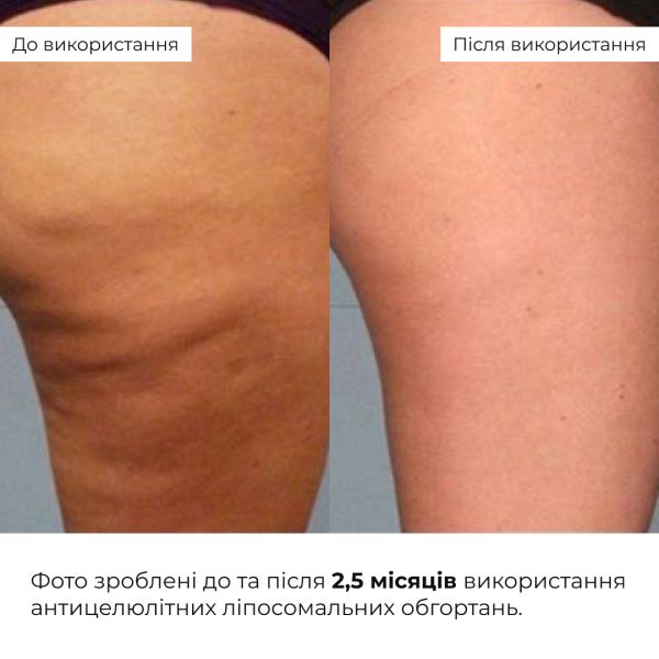 Набор антицеллюлитных охлаждающих обертываний Hillary Cooling Anti-Cellulite Wrap Set