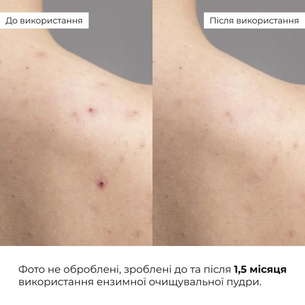 Набор для чувствительной и сухой кожи с центеллой и пробиотиками Hillary Centella & Probiotic