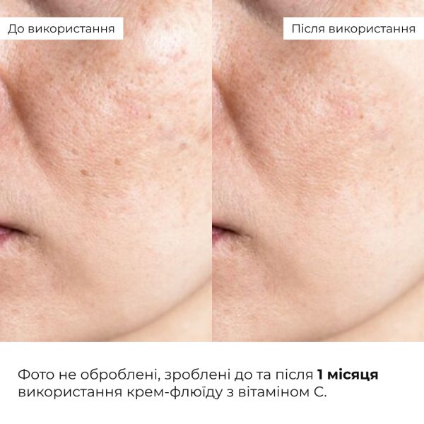 Комплекс для восстановления тона и защита от пигментации SPF 30 Hillary Tone Repair & Pigment Defense Set