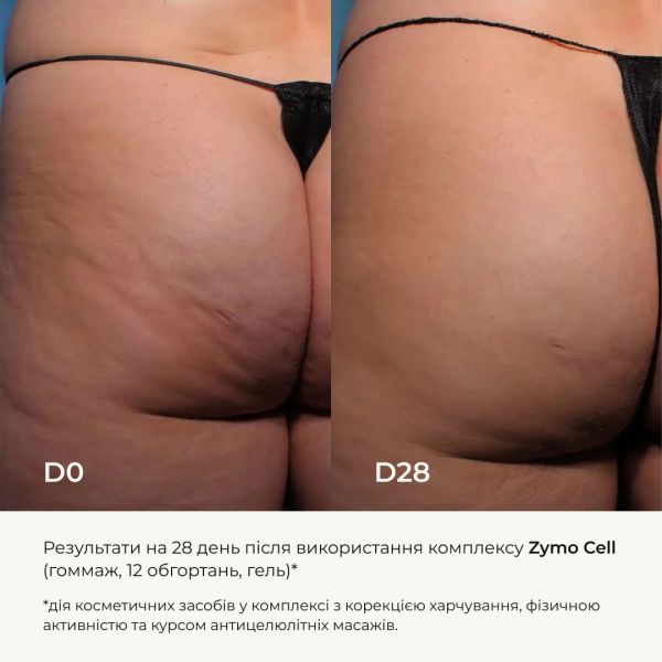 Антицеллюлитный энзимный гель + Антицеллюлитный энзимный гоммаж Zymo Cell