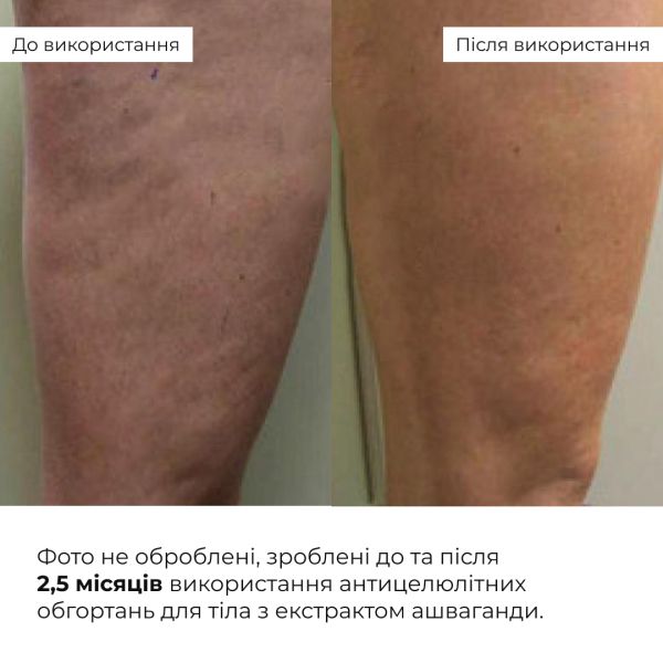 Антицеллюлитные моделирующие обертывания для тела с экстрактом ашваганды Hillary Ashwagandha Hot Slim