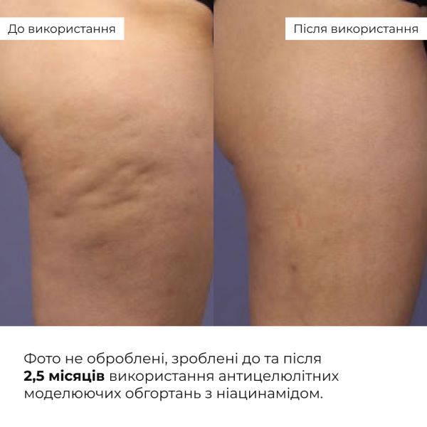 Антицеллюлитные моделирующие обертывания для тела с ниацинамидом Hillary Niacinamide Cold Slim