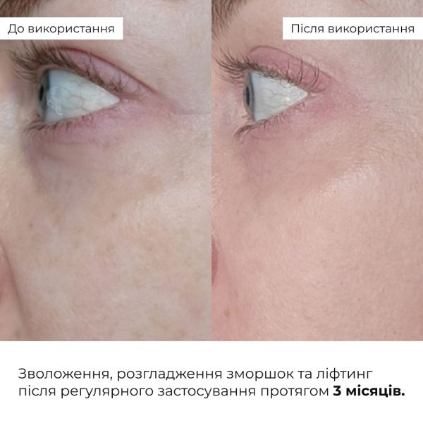 Антивековой базовый уход для лица Hillary Basic Anti-Aging Care