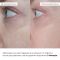 Антивековой базовый уход для лица Hillary Basic Anti-Aging Care