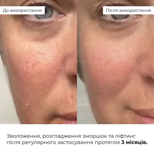 Антивековой ежедневный уход за лицом Hillary Daily Anti-Aging Care