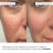 Антивековой ежедневный уход за лицом Hillary Daily Anti-Aging Care