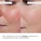 Набор для глубокой очистки и себоконтроля кожи Hillary Deep Cleansing & Sebum Control Set