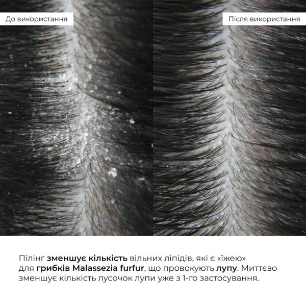 Энзимный трихологический пилинг для кожи головы Hillary Enzyme Trichological Scalp Peel, 120 мл