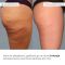 Комплекс детокса для тела Hillary Body Detox Complex