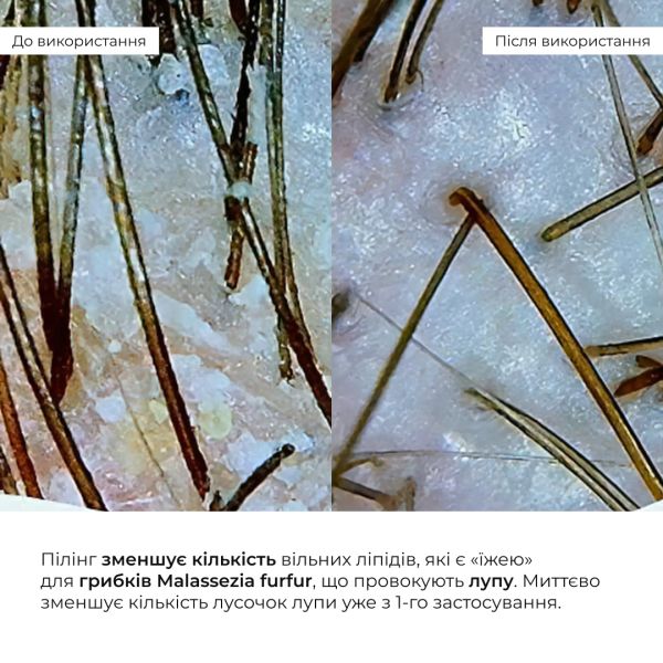 Комплекс для сухих и поврежденных волос Hillary Perfect Care Hair Aloe