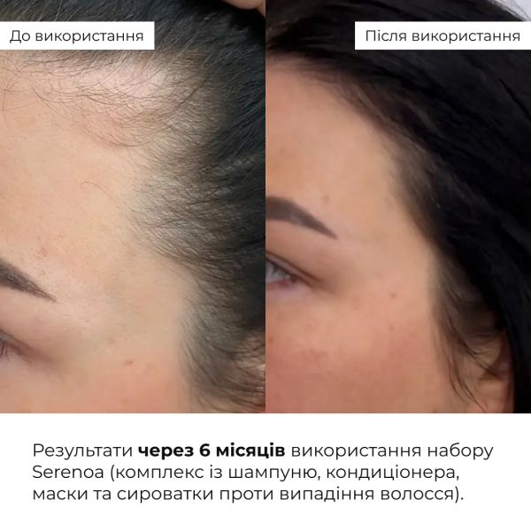 Кондиционер против выпадения волос Hillary Serenoa & РР Hair Loss Control Сonditioner, 250 мл
