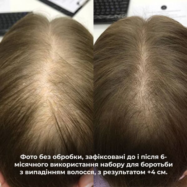 Кондиционер против выпадения волос Hillary Serenoa & РР Hair Loss Control Сonditioner, 500 мл