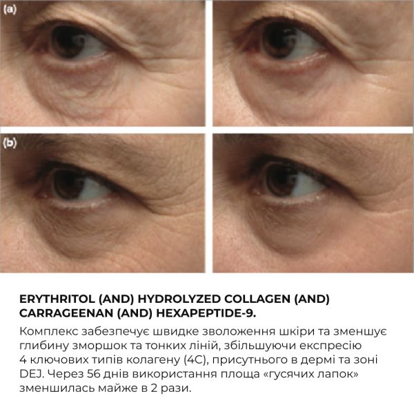 Крем для комплексного омолодження шкіри навколо очей Hillary ReNuAge Time Warp Eye Cream, 15 мл