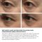 Крем для комплексного омолодження шкіри навколо очей Hillary ReNuAge Time Warp Eye Cream, 15 мл