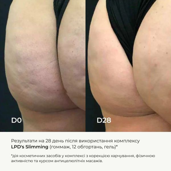 Курс для антицеллюлитного ухода в домашних условиях с активным липосомальным антицеллюлитным комплексом Hillary LPD'S Slimming