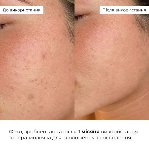 Набор для увлажнения и выравнивания тона Hillary 365 Hydration & Glow Set