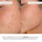 Набор для восстановления и осветления чувствительной кожи Hillary Sensitive Skin Recovery & Glow Set