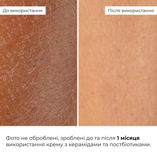 Набор для восстановления и осветления чувствительной кожи Hillary Sensitive Skin Recovery & Glow Set