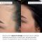 Набор комплексного ухода против выпадения волос Hillary Perfect Hair Serenoa