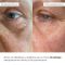 Освіжаючі та Розгладжувальні патчі під очі Hillary Bacuchiol Wrinkle Correcting & Vitamin C Refreshing