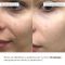 Освіжаючі та Розгладжувальні патчі під очі Hillary Bacuchiol Wrinkle Correcting & Vitamin C Refreshing