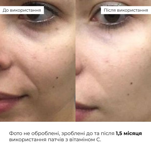 Освіжаючі зміцнювальні патчі з вітаміном C Hillary Vitamin C Refreshing & Firming Eye Patches, 60 шт