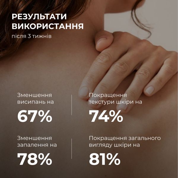 Сироватка для проблемної шкіри з саліциловою кислотою Hillary Back & Body Acne Control Serum, 50 мл