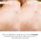 Сироватка для проблемної шкіри з саліциловою кислотою Hillary Back & Body Acne Control Serum, 50 мл
