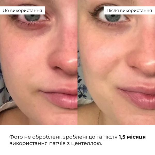 Заспокійливі патчі з центеллою Hillary Сentella Moisturizing & Soothing Eye Patches, 60 шт