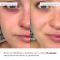 Заспокійливі патчі з центеллою Hillary Сentella Moisturizing & Soothing Eye Patches, 60 шт